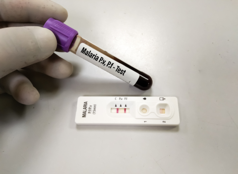 Imagem de um teste de malária